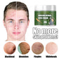 OHS beauty Acne Removal Cream Moisturizing Face Ginseng Acne Skin Care